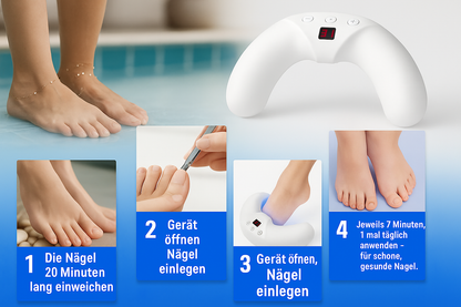 PodoBEAM™ – Die innovative Lasertherapie gegen Nagelpilz